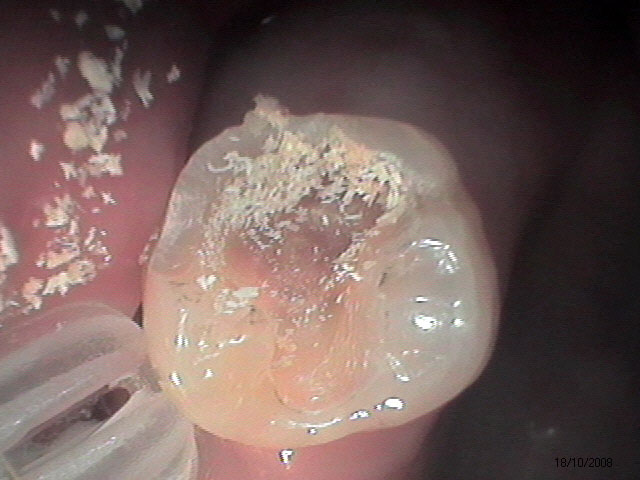 Caso Clínico - Restaurações na Odontologia Moderna