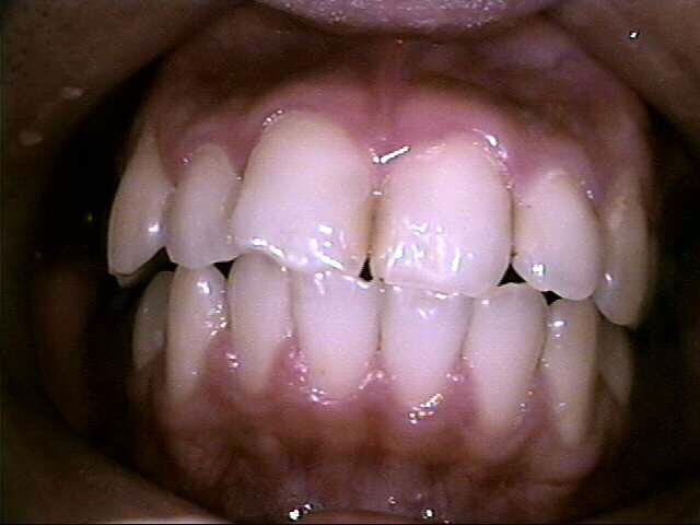 Caso Clínico - Tratamento de Estética